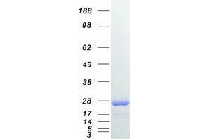 Validation with Western Blot (RAB7A Protein (Myc-DYKDDDDK Tag))