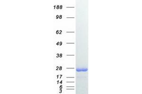 RAB7A Protein (Myc-DYKDDDDK Tag)