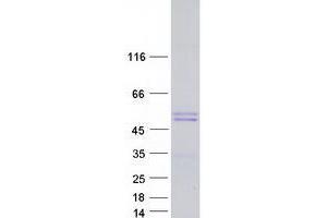 Western Blotting (WB) image for WW Domain Containing E3 Ubiquitin Protein Ligase 2 (WWP2) (Transcript Variant 3) protein (Myc-DYKDDDDK Tag) (ABIN2735643)
