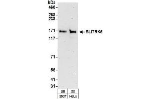 anti-SLIT and NTRK-Like Family, Member 5 (SLITRK5) (AA 875-925) antibody