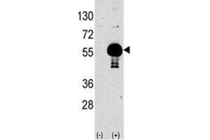 Western blot analysis of AKT2 antibody and 293 lysate transiently transfected with the human gene (2ug/lane). (AKT2 Antikörper  (AA 93-123))