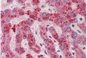 Human Liver: Formalin-Fixed, Paraffin-Embedded (FFPE) (14-3-3 zeta Antikörper  (C-Term))