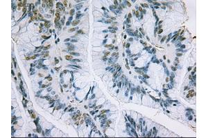 Immunohistochemical staining of paraffin-embedded liver using anti-EpCAM (ABIN2452541) mouse monoclonal antibody. (EpCAM Antikörper  (AA 24-265))