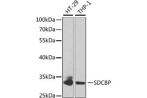 Western blot analysis of extracts of various cell lines, using SDCBP antibody. (SDCBP Antikörper)