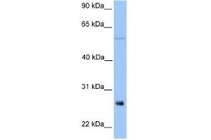 METTL7B antibody used at 1 ug/ml to detect target protein. (METTL7B Antikörper  (Middle Region))