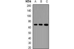 Western blot analysis of CD66f expression in SW480 (A), A549 (B), Hela (C) whole cell lysates.