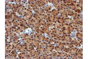 Image no. 3 for anti-Mannose Phosphate Isomerase (MPI) antibody (ABIN1499545) (MPI Antikörper)