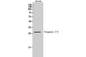 Western Blotting (WB) image for anti-Cardiac Troponin C (TNNC1) antibody (ABIN3180933) (TNNC1 Antikörper)