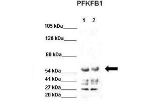 WB Suggested Anti-PFKFB1 Antibody  Positive Control: Lane 1: 40ug HEK293 lysate Lane 2: 40ug H1299 lysate  Primary Antibody Dilution :  1:1000 Secondary Antibody : Goat anti-rabbit-HRP  Secondry Antibody Dilution :  1:5000 Submitted by: Jose Luis Rosa, Universitat de Barcelona (PFKFB1 Antikörper  (C-Term))