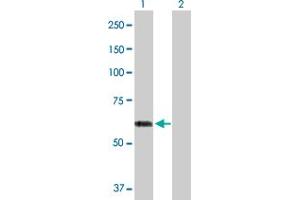 Western Blot analysis of ACCS expression in transfected 293T cell line by ACCS MaxPab polyclonal antibody. (PHACS Antikörper  (AA 1-501))