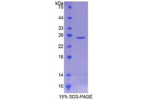 SDS-PAGE analysis of Rat SIAL2 Protein. (Sialidase 2, Cytosolic Protein)