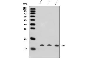 Western blot analysis of LSM5 using anti-LSM5 antibody (ABIN7602503).