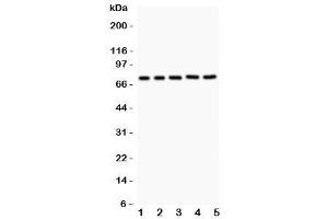 Western blot testing of RIP1 antibody and Lane 1:  Jurkat (RIPK1 Antikörper  (AA 316-671))
