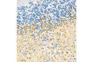 Immunohistochemistry (Paraffin-embedded Sections) (IHC (p)) image for anti-Homer Homolog 3 (Drosophila) (HOMER3) antibody (ABIN7074257)