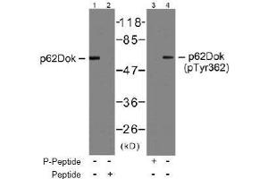 Image no. 2 for anti-Docking Protein 1, 62kDa (Downstream of tyrosine Kinase 1) (DOK1) (AA 360-364) antibody (ABIN197536) (DOK1 Antikörper  (AA 360-364))