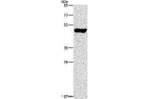 Western blot analysis of Mouse pancreas tissue, using ILK Polyclonal Antibody at dilution of 1:550 (ILK Antikörper)