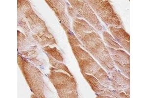 Immunohistochemical analysis of paraffin-embedded mouse skeletal muscle using Musk antibody at 1:25 dilution. (MUSK Antikörper)