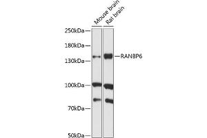 Western blot analysis of extracts of various cell lines, using R antibody (ABIN7269845) at 1:1000 dilution. (RANBP6 Antikörper  (AA 1-70))