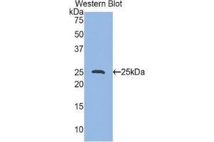 Western blot analysis of the recombinant protein. (HSP27 Antikörper  (AA 1-209))