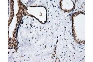 Immunohistochemical staining of paraffin-embedded prostate tissue using anti-APP mouse monoclonal antibody. (APP Antikörper)