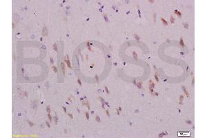 Immunohistochemistry (IHC) image for anti-Sema Domain, Immunoglobulin Domain (Ig), Transmembrane Domain (TM) and Short Cytoplasmic Domain, (Semaphorin) 4C (SEMA4C) (AA 751-833) antibody (ABIN737991)