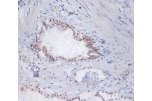 Immunohistochemistry of paraffin-embedded human prostate tissue using ABIN7150599 at dilution of 1:100