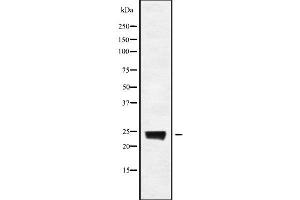 Western blot analysis of RAB8A using COS7 whole cell lysates (RAB8A Antikörper)