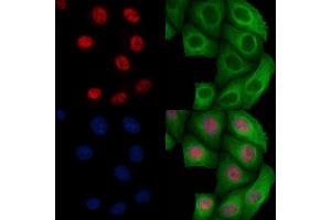 ABIN6256450 and ABIN6267096 staining Heat-shock treated Hela cells by IF/ICC. (BCL9L Antikörper  (pSer915))