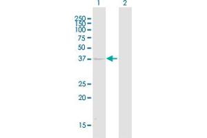 Western Blot analysis of KIR2DL1 expression in transfected 293T cell line ( H00003802-T01 ) by KIR2DL1 MaxPab polyclonal antibody.