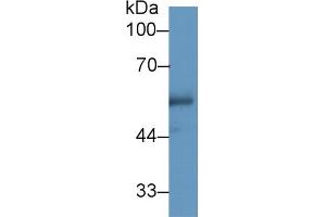 Western Blot; Sample: Human Urine; Primary Ab: 1µg/ml Rabbit Anti-Human CETP Antibody Second Ab: 0. (CETP Antikörper  (AA 353-443))