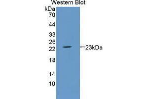 Western blot analysis of the recombinant protein. (LCN5 Antikörper  (AA 28-187))