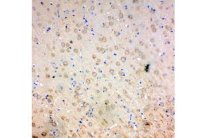 Immunohistochemistry (IHC) image for anti-Superoxide Dismutase 2, Mitochondrial (SOD2) (AA 45-62), (N-Term) antibody (ABIN3044165)