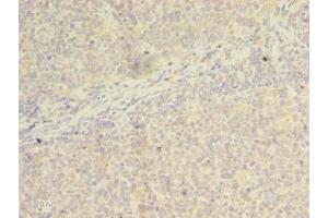 Immunohistochemistry of paraffin-embedded human tonsil tissue using ABIN7175746 at dilution of 1:100 (WDR37 Antikörper  (AA 1-264))