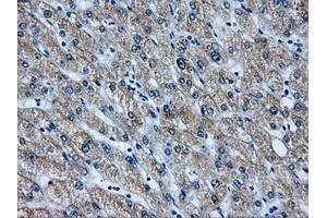 Immunohistochemical staining of paraffin-embedded liver tissue using anti-AKR1A1mouse monoclonal antibody. (AKR1A1 Antikörper)