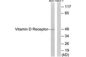 Western blot analysis of extracts from MCF-7 cells, using Vitamin D Receptor (Ab-208) Antibody.