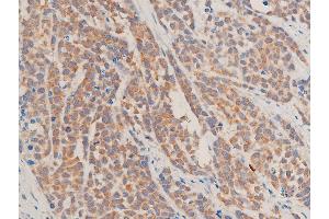 Immunohistochemistry (IHC) image for anti-Transforming Growth Factor, beta 1 (TGFB1) (C-Term) antibody (ABIN6266431)