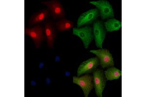 ABIN6257390 and ABIN6273800 staining  cells by IF/ICC. (NRK Antikörper  (N-Term))