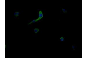 Immunofluorescent analysis of MCF-7 cells using ABIN7159013 at dilution of 1:100 and Alexa Fluor 488-congugated AffiniPure Goat Anti-Rabbit IgG(H+L) (MRGPRX2 Antikörper  (AA 286-330))