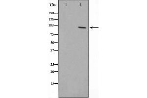 Western blot analysis on HepG2 cell lysate using ZNF148 Antibody，The lane on the left is treated with the antigen-specific peptide. (ZNF148 Antikörper  (N-Term))