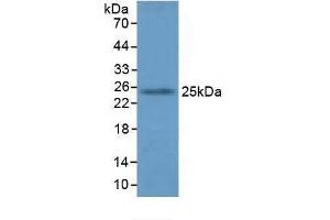 Detection of GSTA4 in Mouse Lung Tissue using Polyclonal Antibody to Glutathione S Transferase A4 (GSTA4) (GSTA4 Antikörper  (AA 1-222))