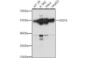 Western blot analysis of extracts of various cell lines, using SRSF6 antibody (ABIN7270217) at 1:1000 dilution.
