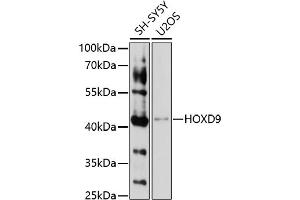 Western blot analysis of extracts of various cell lines, using HOXD9 antibody (ABIN7267776) at 1:1000 dilution. (HOXD9 Antikörper  (AA 100-200))