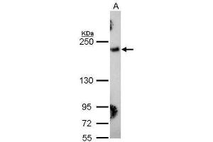 WB Image Sample (30 ug of whole cell lysate) A: Hela 5% SDS PAGE antibody diluted at 1:1000 (COL3A1 Antikörper  (C-Term))