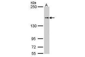 Image no. 2 for anti-Nuclear Factor of Activated T-Cells 5, Tonicity-Responsive (NFAT5) (AA 41-298) antibody (ABIN467533) (NFAT5 Antikörper  (AA 41-298))