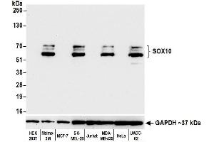Western Blotting (WB) image for anti-SRY (Sex Determining Region Y)-Box 10 (SOX10) (AA 416-466) antibody (ABIN7454037) (Rekombinanter SOX10 Antikörper  (AA 416-466))