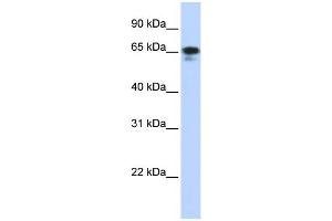 WB Suggested Anti-ZNF276 Antibody Titration:  0. (ZNF276 Antikörper  (Middle Region))