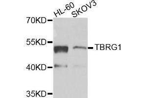 Western blot analysis of extracts of HL60 and SKOV3 cells, using TBRG1 antibody. (TBRG1 Antikörper)