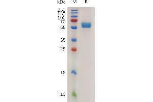 SDS-PAGE (SDS) image for Tumor Necrosis Factor (Ligand) Superfamily, Member 9 (TNFSF9) protein (Fc Tag) (ABIN7491141)