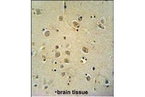 ZIC3 Antibody (Center) (ABIN650719 and ABIN2839389) immunohistochemistry analysis in formalin fixed and paraffin embedded human brain tissue followed by peroxidase conjugation of the secondary antibody and DAB staining.