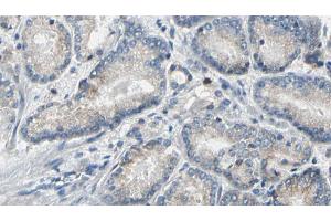 ABIN6269324 at 1/100 staining Human prostate tissue by IHC-P.